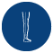 sciatica